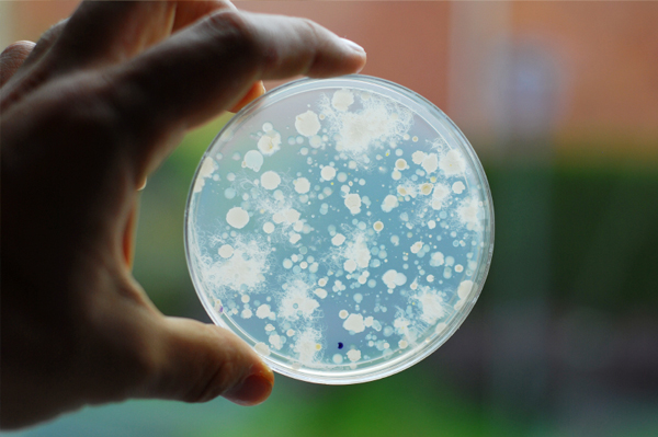 bacteria-in-petri-dish